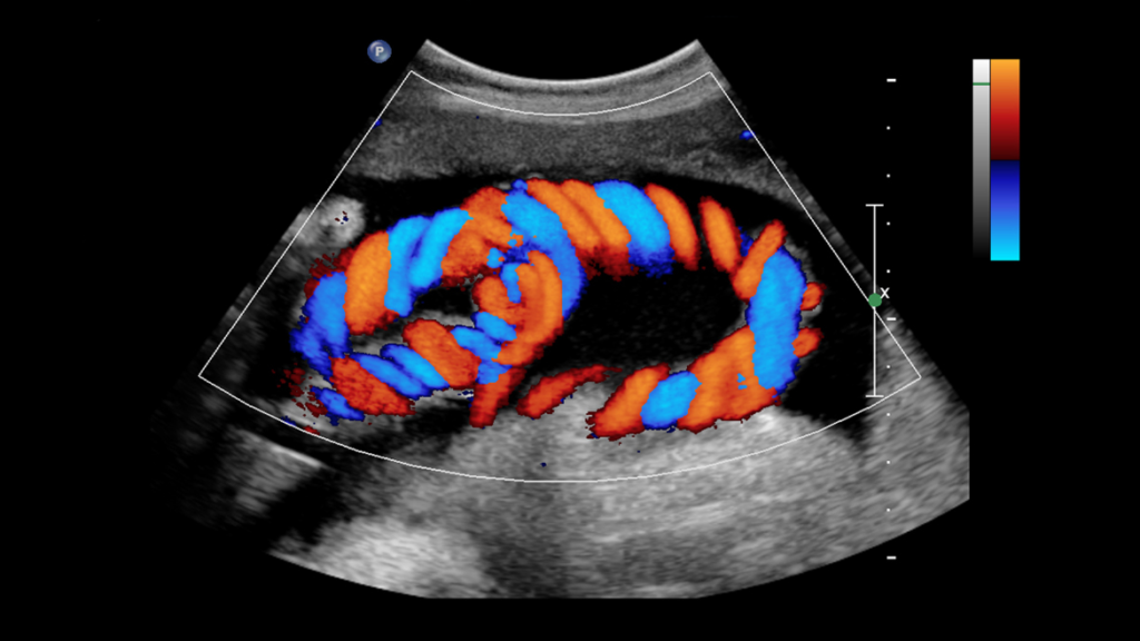 thane ultrasound